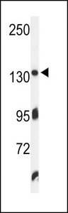 TJP1 / ZO-1 Antibody - Western blot of ZO1 Antibody in K562 cell line lysates (35 ug/lane). ZO1 (arrow) was detected using the purified antibody.
