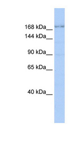 TJP1 / ZO-1 Antibody - TJP1 / ZO-1 antibody Western blot of HepG2 cell lysate. This image was taken for the unconjugated form of this product. Other forms have not been tested.