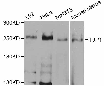 TJP1 / ZO-1 Antibody - Western blot analysis of extracts of various cell lines, using TJP1 antibody at 1:1000 dilution. The secondary antibody used was an HRP Goat Anti-Rabbit IgG (H+L) at 1:10000 dilution. Lysates were loaded 25ug per lane and 3% nonfat dry milk in TBST was used for blocking. An ECL Kit was used for detection and the exposure time was 15s.