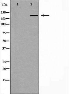 TJP1 / ZO-1 Antibody - Western blot analysis of ZO 1 expression in human brain. The lane on the left is treated with the antigen-specific peptide.