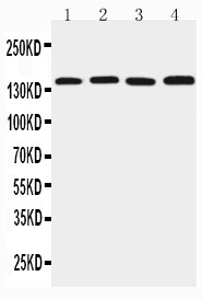 TJP2 / ZO2 / ZO-2 Antibody - WB of TJP2 / ZO2 / ZO-2 antibody. Lane 1: Rat Brain Tissue Lysate. Lane 2: PC-12 Cell Lysate. Lane 3: Mouse Brain Tissue Lysate. Lane 4: HEPA Cell Lysate.
