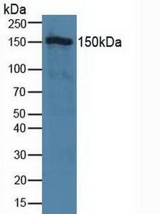 TJP2 / ZO2 / ZO-2 Antibody - Western Blot; Sample: Human Hela Cells.