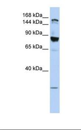 TJP2 / ZO2 / ZO-2 Antibody - MCF7 cell lysate. Antibody concentration: 1.0 ug/ml. Gel concentration: 6-18%.  This image was taken for the unconjugated form of this product. Other forms have not been tested.