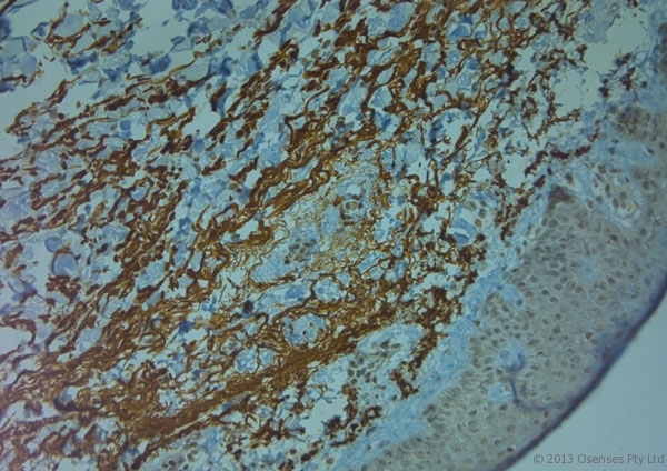 TJP2 / ZO2 / ZO-2 Antibody - Rabbit antibody to ZO2 (740-790). IHC on paraffin sections of human skin tissue using Rabbit antibody to ZO2 (740-790). HIER: 1 mM EDTA, pH 8 for 20 min using Thermo PT Module. Blocking: 0.2% LFDM in TBST filtered through a 0.2 micron filter. Detection was done using Novolink HRP polymer from Leica following manufacturer's instructions. Primary antibody: dilution 1:1000, incubated 30 min at RT (using Autostainer). Sections were counterstained with Harris Hematoxylin.