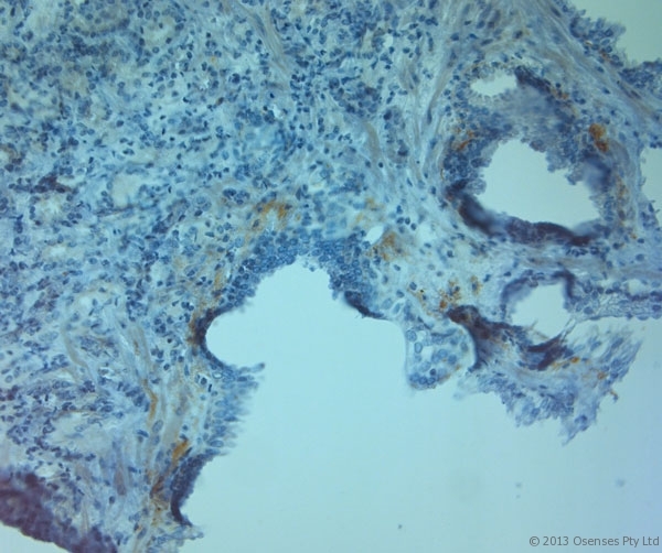 TJP2 / ZO2 / ZO-2 Antibody - Rabbit antibody to ZO2 (740-790). IHC on paraffin sections of human prostate tissue using Rabbit antibody to ZO2 (740-790). HIER: 1 mM EDTA, pH 8 for 20 min using Thermo PT Module. Blocking: 0.2% LFDM in TBST filtered through a 0.2 micron filter. Detection was done using Novolink HRP polymer from Leica following manufacturer's instructions. Primary antibody: dilution 1:1000, incubated 30 min at RT (using Autostainer). Sections were counterstained with Harris Hematoxylin.
