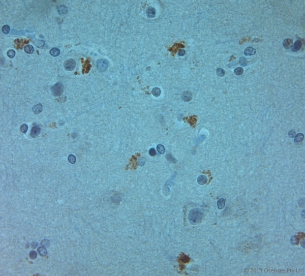 TJP2 / ZO2 / ZO-2 Antibody - Rabbit antibody to ZO2 (740-790). IHC on paraffin sections of human brain tissue using Rabbit antibody to ZO2 (740-790). HIER: 1 mM EDTA, pH 8 for 20 min using Thermo PT Module. Blocking: 0.2% LFDM in TBST filtered through a 0.2 micron filter. Detection was done using Novolink HRP polymer from Leica following manufacturer's instructions. Primary antibody: dilution 1:1000, incubated 30 min at RT (using Autostainer). Sections were counterstained with Harris Hematoxylin.