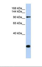 TJP2 / ZO2 / ZO-2 Antibody - Jurkat cell lysate. Antibody concentration: 1.0 ug/ml. Gel concentration: 6-18%.  This image was taken for the unconjugated form of this product. Other forms have not been tested.