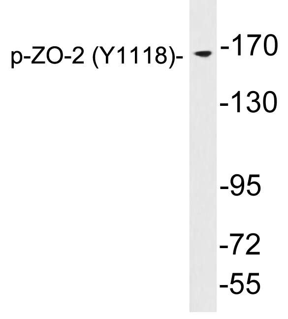 TJP2 / ZO2 / ZO-2 Antibody - Western blot analysis of lysates from brain tissue, using phospho-ZO-2 (Phospho-Y1118) antibody.