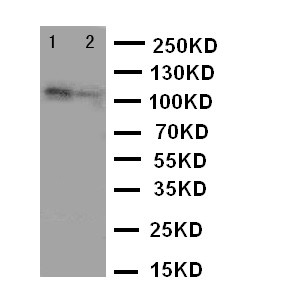 TJP3 / ZO3 Antibody - WB of TJP3 / ZO3 antibody. Lane 1: Rat Brain Tissue Lysate. Lane 2: Rat Heart Tissue Lysate.