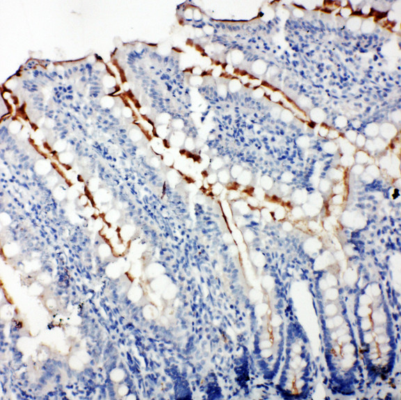 TJP3 / ZO3 Antibody - TJP3 / ZO3 antibody. IHC(P): Rat Intestine Tissue.