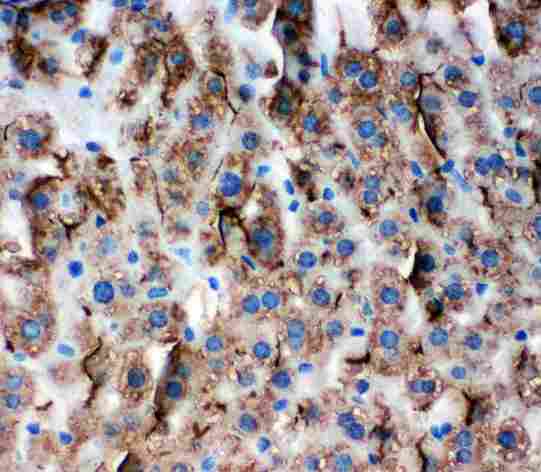 TJP3 / ZO3 Antibody - Anti-Zonula occludens protein 3 antibody, IHC(P): Mouse Liver Tissue
