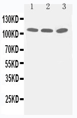TJP3 / ZO3 Antibody - WB of TJP3 / ZO3 antibody. Lane 1: PANC Cell Lysate. Lane 2: A549 Cell Lysate. Lane 3: HELA Cell Lysate.