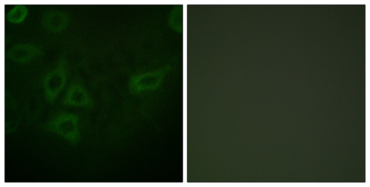 TK1 / TK / Thymidine Kinase Antibody - Immunofluorescence analysis of HepG2 cells, using TK Antibody. The picture on the right is blocked with the synthesized peptide.