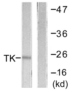 TK1 / TK / Thymidine Kinase Antibody - Western blot analysis of lysates from COLO205 cells, using TK Antibody. The lane on the right is blocked with the synthesized peptide.