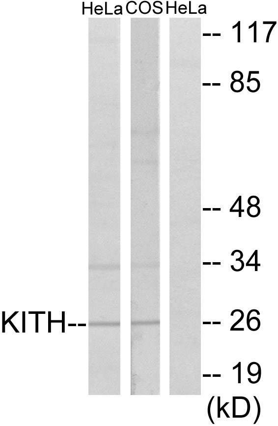 TK1 / TK / Thymidine Kinase Antibody - Western blot analysis of lysates from HeLa and COS7 cells, using KITH Antibody. The lane on the right is blocked with the synthesized peptide.