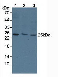 TK1 / TK / Thymidine Kinase Antibody - Western Blot; Sample: Lane1: Human 293T Cells; Lane2: Human MCF7 Cells; Lane3: Human Hela Cells.