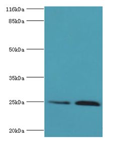 TK1 / TK / Thymidine Kinase Antibody - Western blot. All lanes: TK1 antibody at 2 ug/ml. Lane 1: HeLa whole cell lysate Lane 2: CEM whole cell lysate. Secondary antibody: goat polyclonal to rabbit at 1:10000 dilution. Predicted band size: 25 kDa. Observed band size: 25 kDa.  This image was taken for the unconjugated form of this product. Other forms have not been tested.