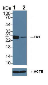 TK1 / TK / Thymidine Kinase Antibody - Knockout Varification: Lane 1: Wild-type 293T cell lysate; Lane 2: TK1 knockout 293T cell lysate; Predicted MW: 25kDaa ; Observed MW: 26kDa; Primary Ab: 3µg/ml Rabbit Anti-Human TK1 Antibody; Second Ab: 0.2µg/mL HRP-Linked Caprine Anti-Rabbit IgG Polyclonal Antibody;