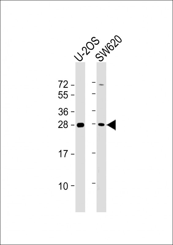 TK1 / TK / Thymidine Kinase Antibody - All lanes: Anti-TK1 Antibody (Center) at 1:2000 dilution Lane 1: U-2OS whole cell lysate Lane 2: SW620 whole cell lysate Lysates/proteins at 20 µg per lane. Secondary Goat Anti-Rabbit IgG, (H+L), Peroxidase conjugated at 1/10000 dilution. Predicted band size: 25 kDa Blocking/Dilution buffer: 5% NFDM/TBST.