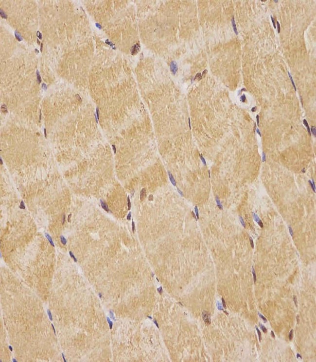 TK1 / TK / Thymidine Kinase Antibody - TK1 Antibody (Center) staining TK1 in human skeletal muscle tissue sections by Immunohistochemistry (IHC-P - paraformaldehyde-fixed, paraffin-embedded sections). Tissue was fixed with formaldehyde and blocked with 3% BSA for 0. 5 hour at room temperature; antigen retrieval was by heat mediation with a citrate buffer (pH6). Samples were incubated with primary antibody (1/25) for 1 hours at 37°C. A undiluted biotinylated goat polyvalent antibody was used as the secondary antibody.