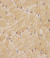 TK1 / TK / Thymidine Kinase Antibody - TK1 Antibody (Center) staining TK1 in human skeletal muscle tissue sections by Immunohistochemistry (IHC-P - paraformaldehyde-fixed, paraffin-embedded sections). Tissue was fixed with formaldehyde and blocked with 3% BSA for 0. 5 hour at room temperature; antigen retrieval was by heat mediation with a citrate buffer (pH6). Samples were incubated with primary antibody (1/25) for 1 hours at 37°C. A undiluted biotinylated goat polyvalent antibody was used as the secondary antibody.