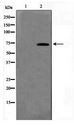 TK1 / TK / Thymidine Kinase Antibody - Western blot of HUVEC cell lysate using KITH_EBV Antibody