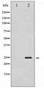 TK1 / TK / Thymidine Kinase Antibody - Western blot of TK expression in COLO205 whole cell lysates,The lane on the left is treated with the antigen-specific peptide.