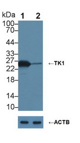 TK1 / TK / Thymidine Kinase Antibody - Knockout Varification: Lane 1: Wild-type MCF7 cell lysate; Lane 2: TK1 knockout MCF7 cell lysate; Predicted MW: 25kDa Observed MW: 25kDa Primary Ab: 6µg/ml Mouse Anti-Human TK1 Antibody Second Ab: 0.2µg/mL HRP-Linked Caprine Anti-Mouse IgG Polyclonal Antibody