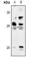 TK1 / TK / Thymidine Kinase Antibody - Western blot analysis of Thymidine Kinase 1 expression in THP1 (A), Jurkat (B) whole cell lysates.