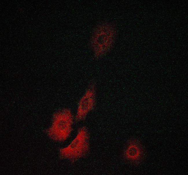 TK1 / TK / Thymidine Kinase Antibody - Staining MCF-7 cells by IF/ICC. The samples were fixed with PFA and permeabilized in 0.1% saponin prior to blocking in 10% serum for 45 min at 37°C. The primary antibody was diluted 1/400 and incubated with the sample for 1 hour at 37°C. A Alexa Fluor® 594 conjugated goat polyclonal to rabbit IgG (H+L), diluted 1/600 was used as secondary antibody.