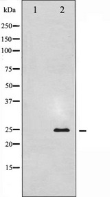 TK1 / TK / Thymidine Kinase Antibody - Western blot analysis of TK expression in COLO205 whole cells lysates. The lane on the left is treated with the antigen-specific peptide.