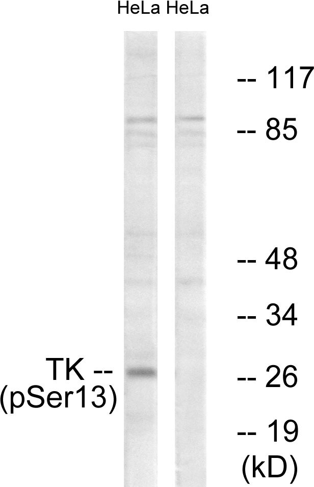 TK1 / TK / Thymidine Kinase Antibody - Western blot analysis of lysates from HeLa cells treated with paclitaxel 1uM 24h, using TK (Phospho-Ser13) Antibody. The lane on the right is blocked with the phospho peptide.