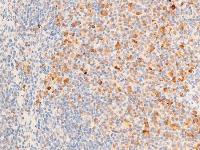 TK1 / TK / Thymidine Kinase Antibody - 1:100 staining mouse spleen tissue by IHC-P. The tissue was formaldehyde fixed and a heat mediated antigen retrieval step in citrate buffer was performed. The tissue was then blocked and incubated with the antibody for 1.5 hours at 22°C. An HRP conjugated goat anti-rabbit antibody was used as the secondary.
