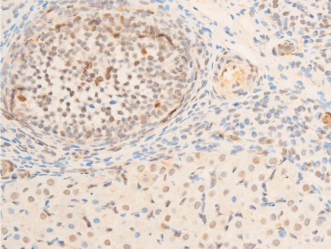 TK1 / TK / Thymidine Kinase Antibody - 1:100 staining rat ovarian tissue by IHC-P. The tissue was formaldehyde fixed and a heat mediated antigen retrieval step in citrate buffer was performed. The tissue was then blocked and incubated with the antibody for 1.5 hours at 22°C. An HRP conjugated goat anti-rabbit antibody was used as the secondary.
