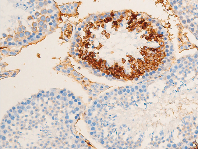 TK1 / TK / Thymidine Kinase Antibody - 1:100 staining mouse testis tissue by IHC-P. The tissue was formaldehyde fixed and a heat mediated antigen retrieval step in citrate buffer was performed. The tissue was then blocked and incubated with the antibody for 1.5 hours at 22°C. An HRP conjugated goat anti-rabbit antibody was used as the secondary.