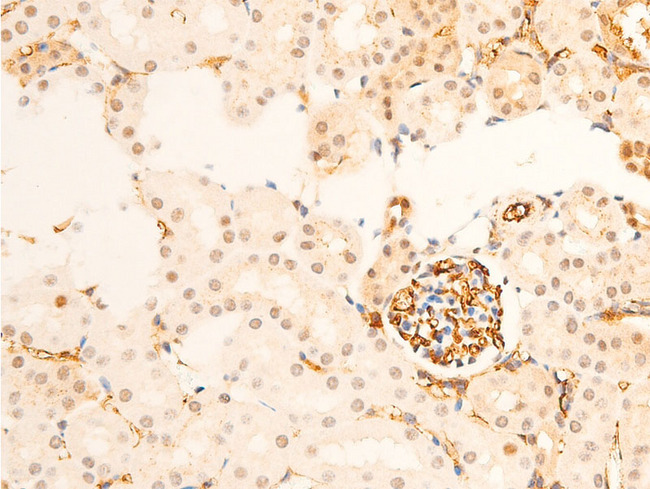 TK1 / TK / Thymidine Kinase Antibody - 1:100 staining mouse kidney tissue by IHC-P. The tissue was formaldehyde fixed and a heat mediated antigen retrieval step in citrate buffer was performed. The tissue was then blocked and incubated with the antibody for 1.5 hours at 22°C. An HRP conjugated goat anti-rabbit antibody was used as the secondary.