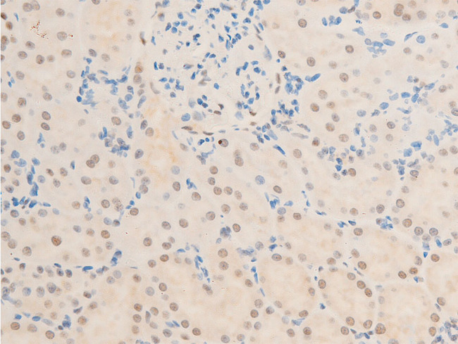 TK1 / TK / Thymidine Kinase Antibody - 1:100 staining rat kidney tissue by IHC-P. The tissue was formaldehyde fixed and a heat mediated antigen retrieval step in citrate buffer was performed. The tissue was then blocked and incubated with the antibody for 1.5 hours at 22°C. An HRP conjugated goat anti-rabbit antibody was used as the secondary.