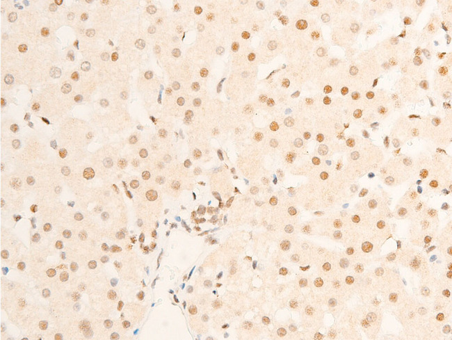 TK1 / TK / Thymidine Kinase Antibody - 1:100 staining human liver tissue by IHC-P. The tissue was formaldehyde fixed and a heat mediated antigen retrieval step in citrate buffer was performed. The tissue was then blocked and incubated with the antibody for 1.5 hours at 22°C. An HRP conjugated goat anti-rabbit antibody was used as the secondary.
