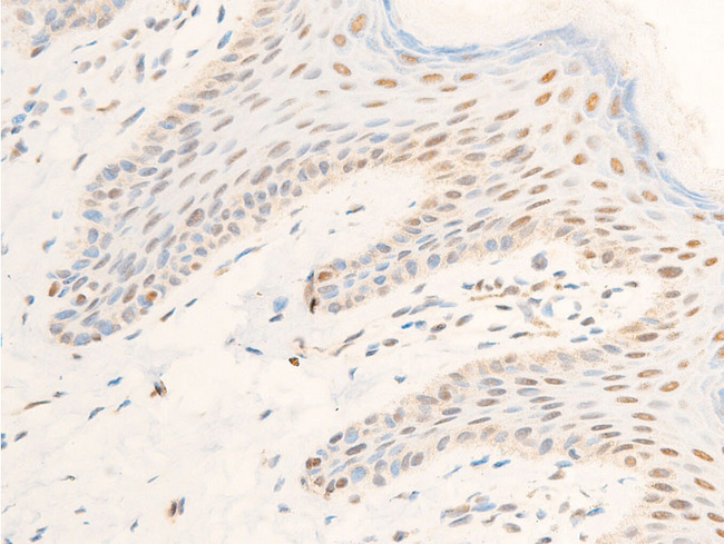 TK1 / TK / Thymidine Kinase Antibody - 1:100 staining human skin tissue by IHC-P. The tissue was formaldehyde fixed and a heat mediated antigen retrieval step in citrate buffer was performed. The tissue was then blocked and incubated with the antibody for 1.5 hours at 22°C. An HRP conjugated goat anti-rabbit antibody was used as the secondary.