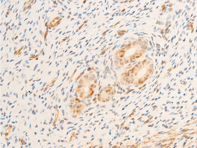 TK1 / TK / Thymidine Kinase Antibody - 1:100 staining rat uterine tissue by IHC-P. The tissue was formaldehyde fixed and a heat mediated antigen retrieval step in citrate buffer was performed. The tissue was then blocked and incubated with the antibody for 1.5 hours at 22°C. An HRP conjugated goat anti-rabbit antibody was used as the secondary.