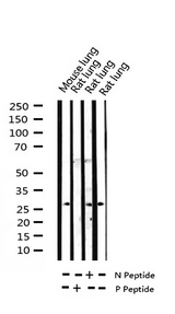 TK1 / TK / Thymidine Kinase Antibody - Western blot analysis of Phospho-TK (Ser13) expression in various lysates