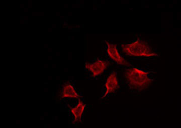 TK1 / TK / Thymidine Kinase Antibody - Staining HeLa cells by IF/ICC. The samples were fixed with PFA and permeabilized in 0.1% Triton X-100, then blocked in 10% serum for 45 min at 25°C. The primary antibody was diluted at 1:200 and incubated with the sample for 1 hour at 37°C. An Alexa Fluor 594 conjugated goat anti-rabbit IgG (H+L) Ab, diluted at 1/600, was used as the secondary antibody.
