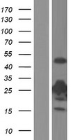 TK1 / TK / Thymidine Kinase Protein - Western validation with an anti-DDK antibody * L: Control HEK293 lysate R: Over-expression lysate