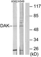 TKFC / DAK Antibody - Western blot analysis of lysates from K562 and A549 cells, using DAK Antibody. The lane on the right is blocked with the synthesized peptide.