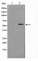 TKFC / DAK Antibody - Western blot of K562 cell lysate using DAK Antibody