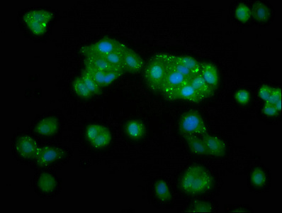 TKFC / DAK Antibody - Immunofluorescence staining of HepG2 cells at a dilution of 1:133, counter-stained with DAPI. The cells were fixed in 4% formaldehyde, permeabilized using 0.2% Triton X-100 and blocked in 10% normal Goat Serum. The cells were then incubated with the antibody overnight at 4 °C.The secondary antibody was Alexa Fluor 488-congugated AffiniPure Goat Anti-Rabbit IgG (H+L) .