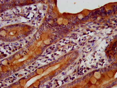 TKFC / DAK Antibody - IHC image of TKFC Antibody diluted at 1:400 and staining in paraffin-embedded human small intestine tissue performed on a Leica BondTM system. After dewaxing and hydration, antigen retrieval was mediated by high pressure in a citrate buffer (pH 6.0). Section was blocked with 10% normal goat serum 30min at RT. Then primary antibody (1% BSA) was incubated at 4°C overnight. The primary is detected by a biotinylated secondary antibody and visualized using an HRP conjugated SP system.
