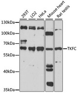 TKFC / DAK Antibody - Western blot analysis of extracts of various cell lines, using TKFC antibody. The secondary antibody used was an HRP Goat Anti-Rabbit IgG (H+L) at 1:10000 dilution. Lysates were loaded 25ug per lane and 3% nonfat dry milk in TBST was used for blocking. An ECL Kit was used for detection and the exposure time was 60s.
