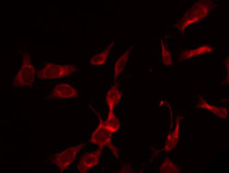 TKFC / DAK Antibody - Staining K562 cells by IF/ICC. The samples were fixed with PFA and permeabilized in 0.1% Triton X-100, then blocked in 10% serum for 45 min at 25°C. The primary antibody was diluted at 1:200 and incubated with the sample for 1 hour at 37°C. An Alexa Fluor 594 conjugated goat anti-rabbit IgG (H+L) Ab, diluted at 1/600, was used as the secondary antibody.