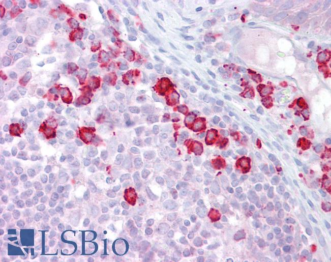 TKFC / DAK Antibody - Anti-DAK antibody IHC of human tonsil. Immunohistochemistry of formalin-fixed, paraffin-embedded tissue after heat-induced antigen retrieval. Antibody concentration 5 ug/ml.  This image was taken for the unconjugated form of this product. Other forms have not been tested.